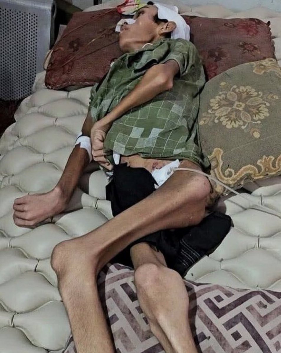 I am so hungry 🇵🇸💔