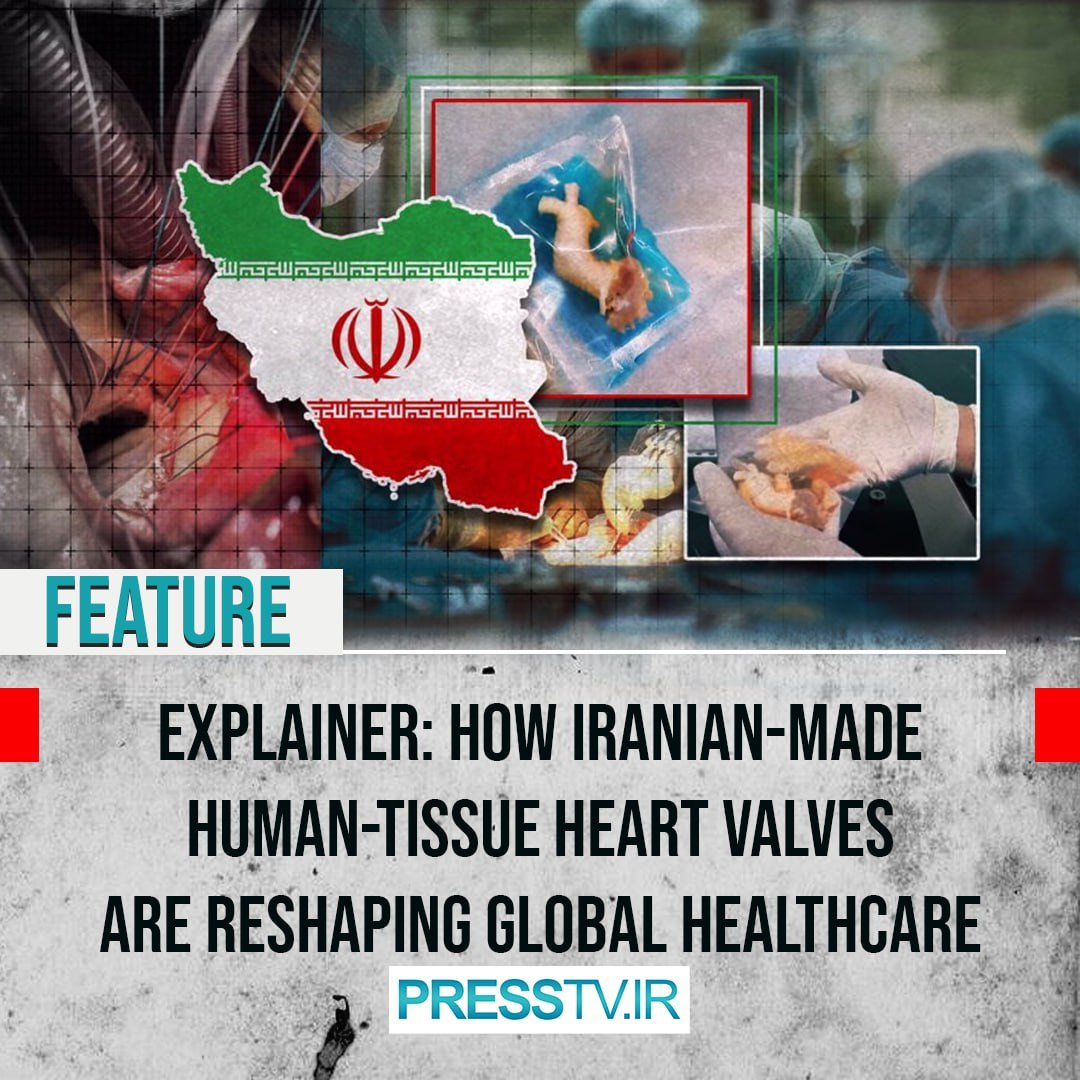 Press TV 🔻 (@presstv) on Twitter photo 🇮🇷 IRAN FIRST | Iran has reached a significant milestone in medical innovation, ranking among the world’s top ten producers of human-tissue heart valves.
By <a href="/kesic_ivan/">Ivan Kesić</a>
#IranFirst
presstv.ir/Detail/2025/07… 🇮🇷 IRAN FIRST | Iran has reached a significant milestone in medical innovation, ranking among the world’s top ten producers of human-tissue heart valves.
By <a href="/kesic_ivan/">Ivan Kesić</a>
#IranFirst
presstv.ir/Detail/2025/07…
