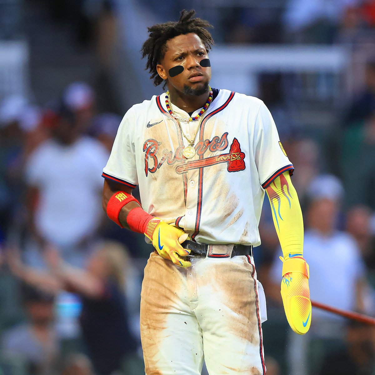 Ronald Acuña Jr. vuelve a la lista de lesionados en la MLB 2025