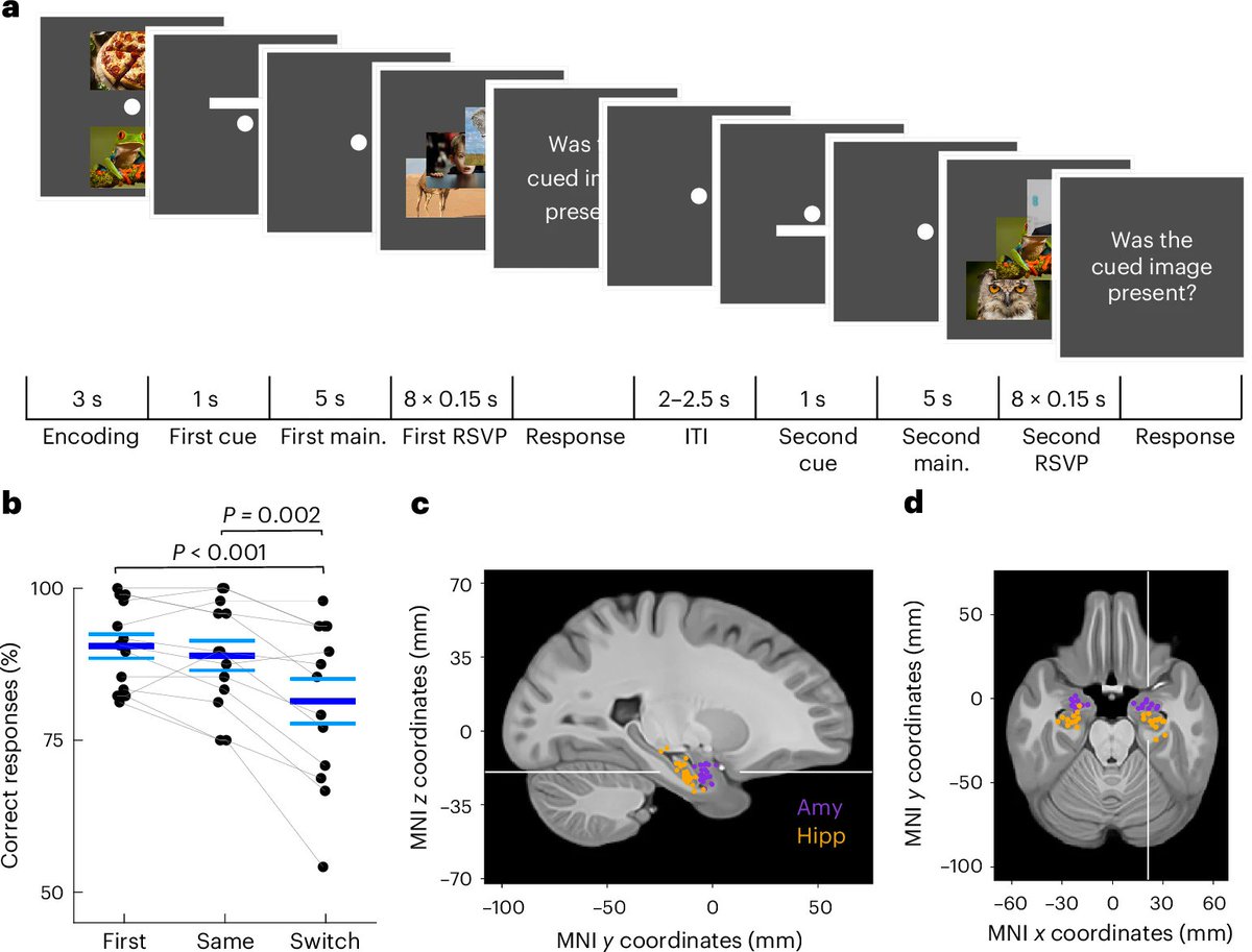AIpubmed's tweet photo. I just published Unattended Items in Working Memory: The Role of Persistent Activity in the Human Medial Temporalโฆ https://t.co/mbgTDqdc8h
#WorkingMemory
#MedialTemporalLobe
#PersistentNeuralActivity
#CognitiveNeuroscience
#NeuralOscillations https://t.co/ZojYUyhzMQ