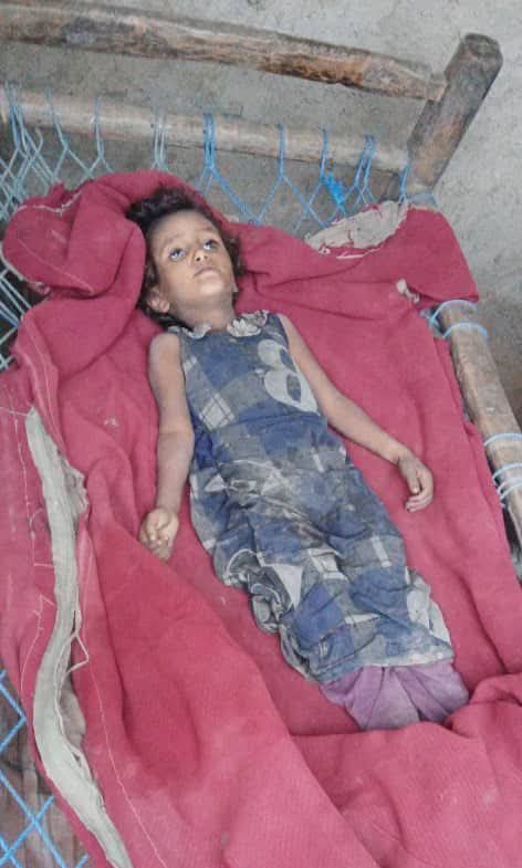 هذه الطفلة البريئة لم تمت في قطاع غزة، بل في محافظة الحديدة اليمنية...
ماتت جوعًاوذبلت كالوردبلا ماء
ليس بسبب حصار خارجي بل بسبب تجويع داخلي ممنهج تمارسه ميليشيا الحوثي الانقلابية.
ماتت لأن هذه الجماعةنهبت مرتبات ومدخرات الموظفين والبنوك وصادرت حقوق الشعب، وانقلبت على الدولة