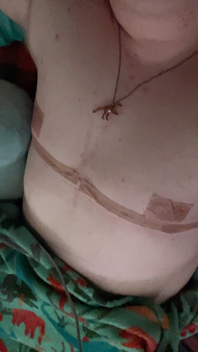 LeoooTheGreat's tweet photo. I keep forgetting this app exists. Anyway I’m over 6 weeks post op :) https://t.co/6ilquBkqMy