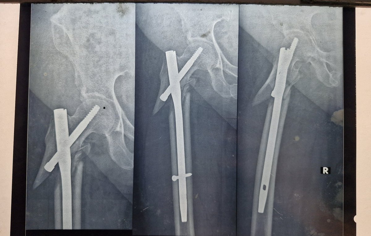 Orthopod tweet media