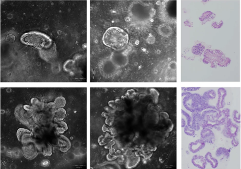 🧫 This study introduces a colon organoid model valuable for studying colorectal cancer and developing new diagnostic, preventive, and therapeutic approaches to prevent or delay tumorigenesis in familial adenomatous polyposis patients.

👉 go.nature.com/4muH3TZ