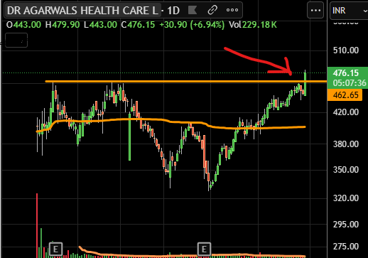 doshirajeshr's tweet image. #IPO BASE BO  #AGARWALEYE 
CMP 476/- SL 450