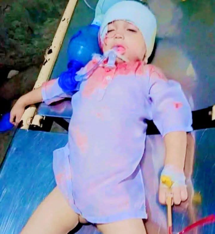 Pakarmyporn's tweet photo. مقبوضہ باجوڑ میں سکیورٹی فورسز کی آپریشن میں کم عمر بچہ زخموں کی تاب نہ لاتے ہوئے شہید ہوگیا 🥺💔😪

 #باجوڑ_اپریشن https://t.co/I2vprNSO7v