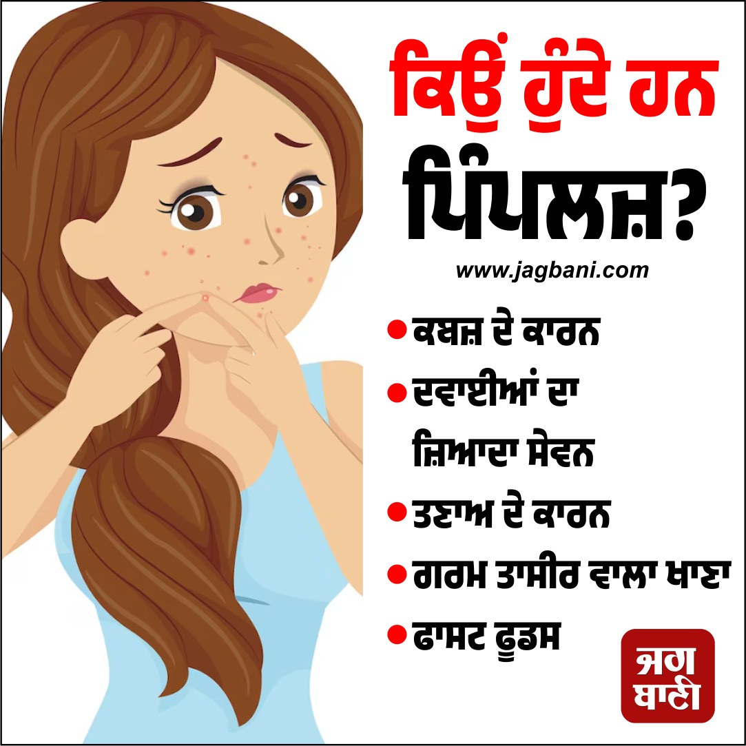 JagbaniOnline's tweet image. ਕਿਉਂ ਹੁੰਦੇ ਹਨ ਪਿੰਪਲਜ਼?
#Pimples #SkinCareTips #BeautyTips #Jagbani