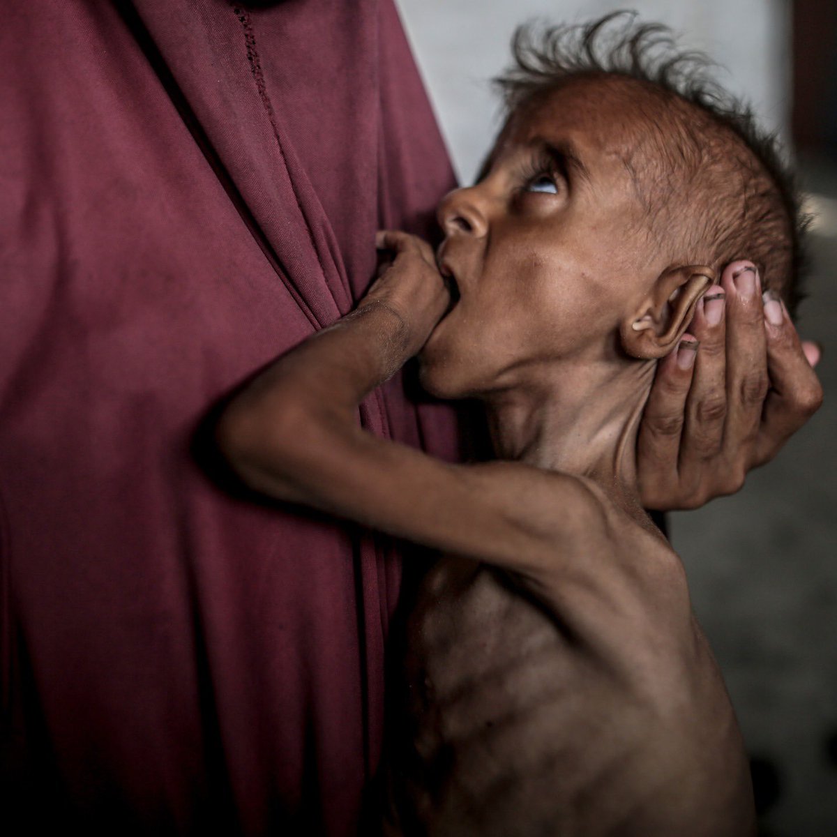 Gaza doesn’t have enough food for the children. It’s not famine. It’s forced starvation. Forced starvation is an act of genocide.

Keep speaking about Gaza, even if you're alone.

Don't look away.
Don't normalize genocide.