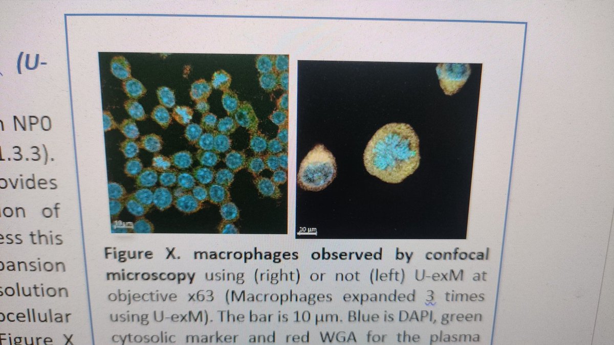 Never give up on the ANR granting..😅 ❤️ with one month delay because as good french we complained.  thanks for supporting us with the new project Ima-ClickChe. The future of neuroprostane signaling is there. #ANR
#oxylipin