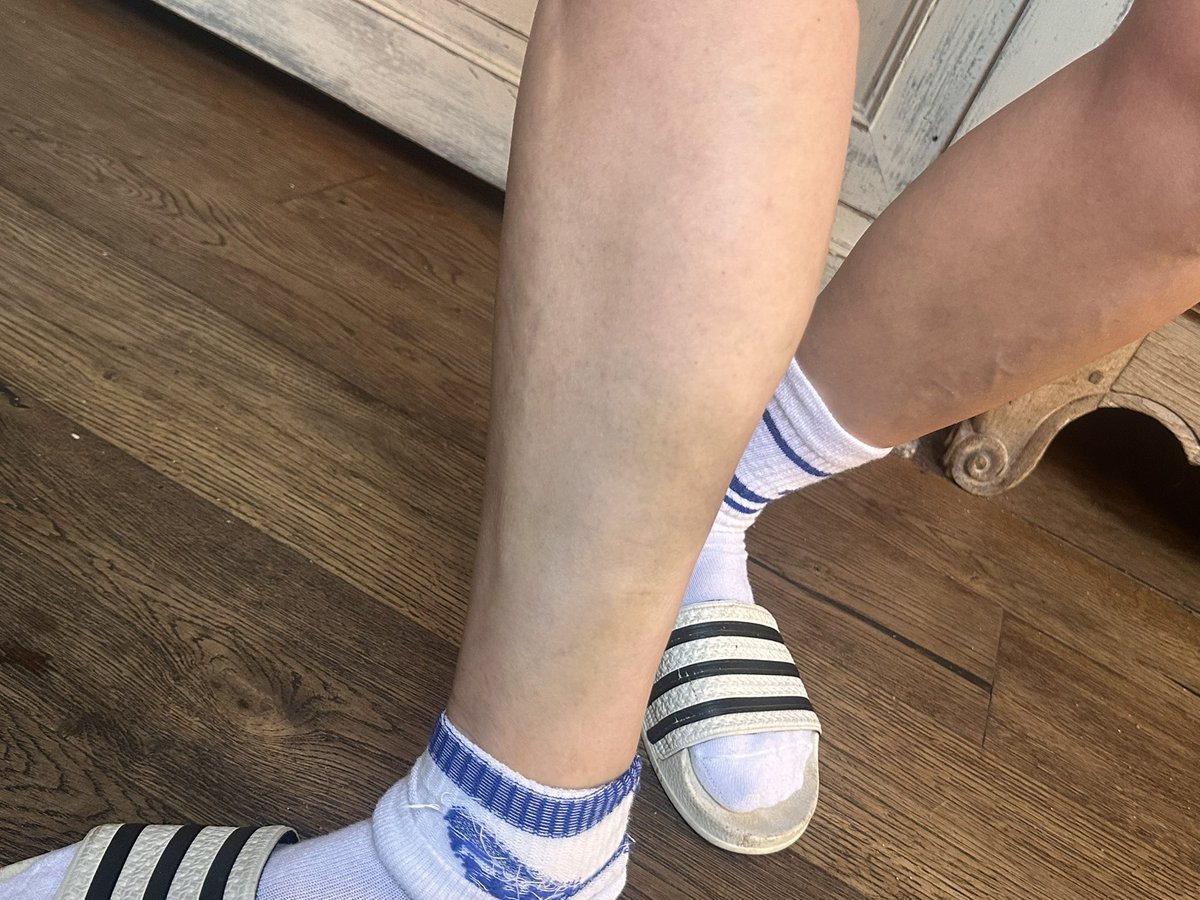 Logging for timestamp and because <a href="/LightninLex/">LightninLex 🏴</a> has even worse bruises than me. I didn’t want to post hers but she’s given permission. You should be very ashamed of your security <a href="/OfficialPDC/">PDC Darts</a> if this is how you treat a lesbian woman who had stayed in her seat until your security