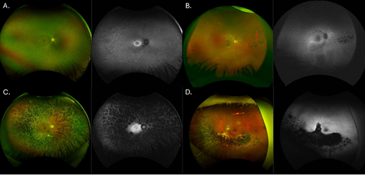 IOVS Journal tweet media
