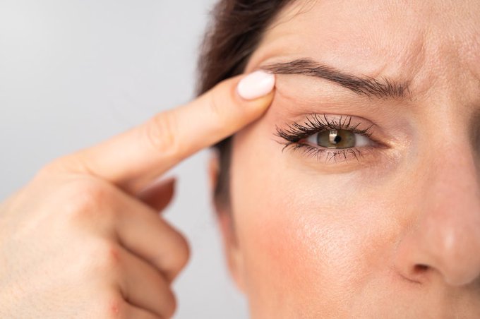 تقنية البلازماج لشد الجفون.. ابتكار جمالي يمنحك نظرة شابة 