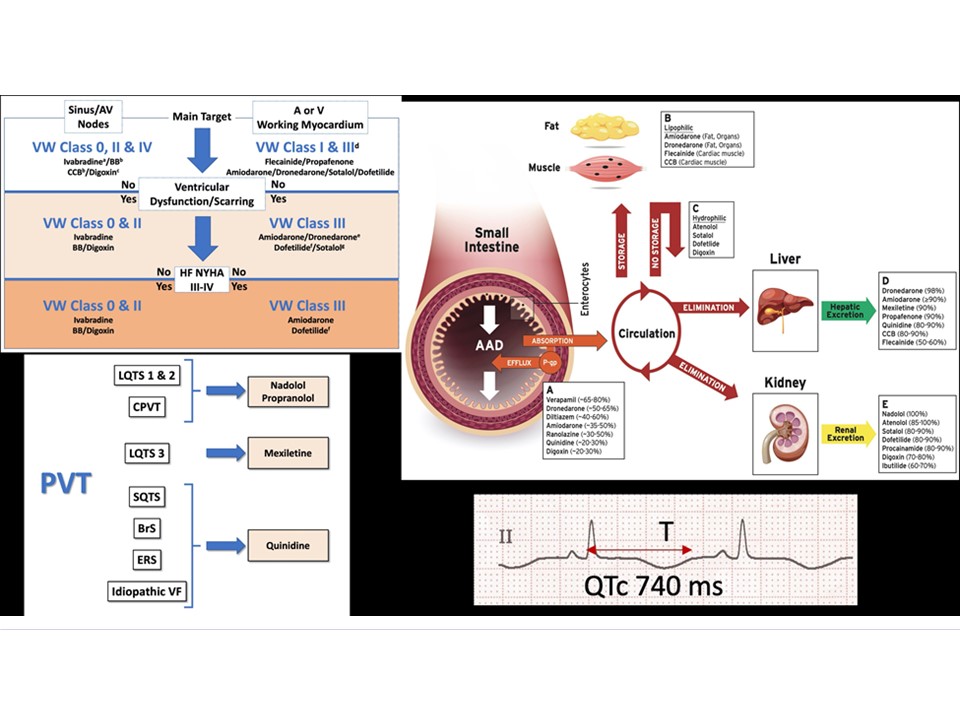 European Society of Cardiology Journals (@esc_journals) on Twitter photo 🗞️ Practical Compendium of Antiarrhythmic Drugs: A Clinical Consensus Statement of the European Heart Rhythm Association 👉ow.ly/nqXw50Wsz6h #EHRA_ESC
<a href="/EuropaceEiC/">Europace Editor-in-Chief</a> <a href="/GiulioConte9/">Giulio Conte</a> <a href="/Dominik_Linz/">Dominik Linz</a> <a href="/FraSantoroMD/">Francesco Santoro, MD, PhD</a> <a href="/AndyZhangMD/">Xiaodong Zhang (Andy), MD, PhD, FHRS, FACC</a> <a href="/marcovitoloMD/">Marco Vitolo Ⓜ️</a> <a href="/DavideMei93/">Davide Mei</a> #Europace #arrhythmias 🗞️ Practical Compendium of Antiarrhythmic Drugs: A Clinical Consensus Statement of the European Heart Rhythm Association 👉ow.ly/nqXw50Wsz6h #EHRA_ESC
<a href="/EuropaceEiC/">Europace Editor-in-Chief</a> <a href="/GiulioConte9/">Giulio Conte</a> <a href="/Dominik_Linz/">Dominik Linz</a> <a href="/FraSantoroMD/">Francesco Santoro, MD, PhD</a> <a href="/AndyZhangMD/">Xiaodong Zhang (Andy), MD, PhD, FHRS, FACC</a> <a href="/marcovitoloMD/">Marco Vitolo Ⓜ️</a> <a href="/DavideMei93/">Davide Mei</a> #Europace #arrhythmias