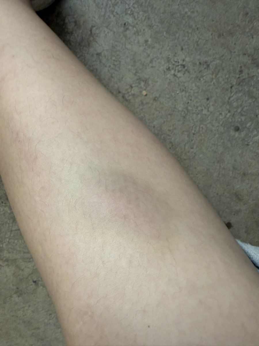 เด๋อสุด