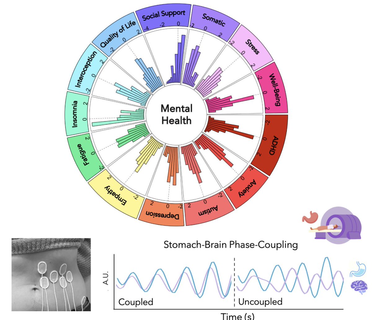 Got Butterflies in your Stomach? I am super excited to share the first major publication of my postdoc <a href="/visceral_mind/">The ECG</a> - Now out in <a href="/NatMentHealth/">Nature Mental Health</a>! We report a multidimensional mental health signature of stomach-brain coupling in the largest sample to date nature.com/articles/s4422…
