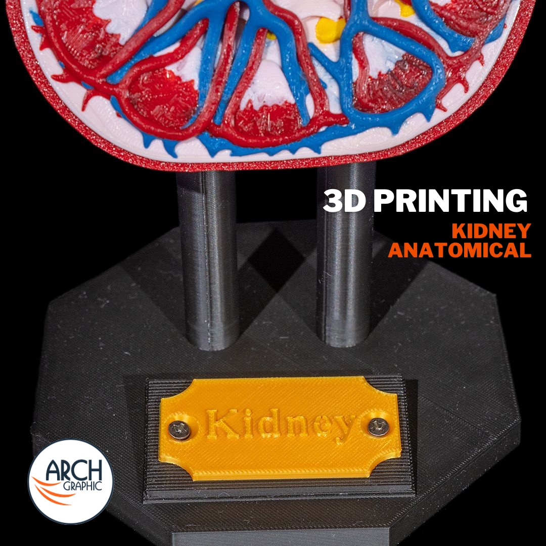 3d_archgraphic's tweet image. 🩺 3D Printed Kidney Anatomical Model 🏥
High-precision medical model for education, research
📍 Made in UAE
arch-graphic.com
#3DPrintingUAE #Medical3DPrinting #KidneyModel #AnatomicalModels #Healthcare3DPrinting #MedicalEducationUAE #SurgicalTraining #UAE3DPrint