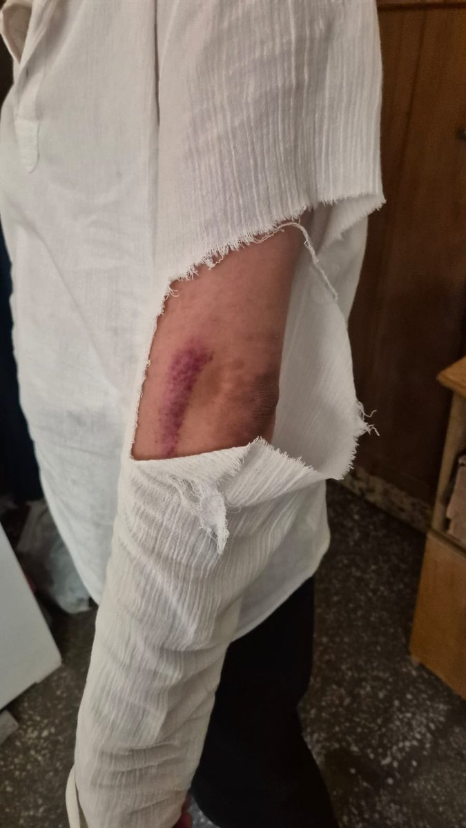 <a href="/yilmaztunc/">Yılmaz TUNÇ</a> <a href="/AliYerlikaya/">Ali Yerlikaya</a>  <a href="/gantepvaliligi/">Gaziantep Valiliği</a> <a href="/FatmaSahin/">Fatma Şahin</a> <a href="/TC_icisleri/">T.C. İçişleri Bakanlığı</a> <a href="/adalet_bakanlik/">T.C. Adalet Bakanlığı</a> <a href="/gazianteppolis/">Gaziantep Emniyet Müdürlüğü</a> Zeugma Taksi sürücüleri çete kurup 7 sürücu çağırdıklari bir Martı Tag motor sürücüsünü darp ediyorlar. Kimse bu çetelere dur demeyecek mi? Yoksa bu ülkede adalet kalmadı mı?