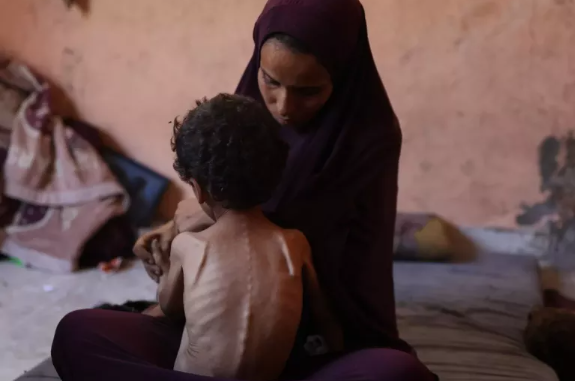 En Gaza, niños y bebés mueren por desnutrición.  Necesitamos acceso humanitario inmediato y sin obstáculos.  Sin eso, las madres seguirán viendo importantes cómo sus hijos mueren por una enfermedad que podemos prevenir unicef.es/noticia/gaza-s…