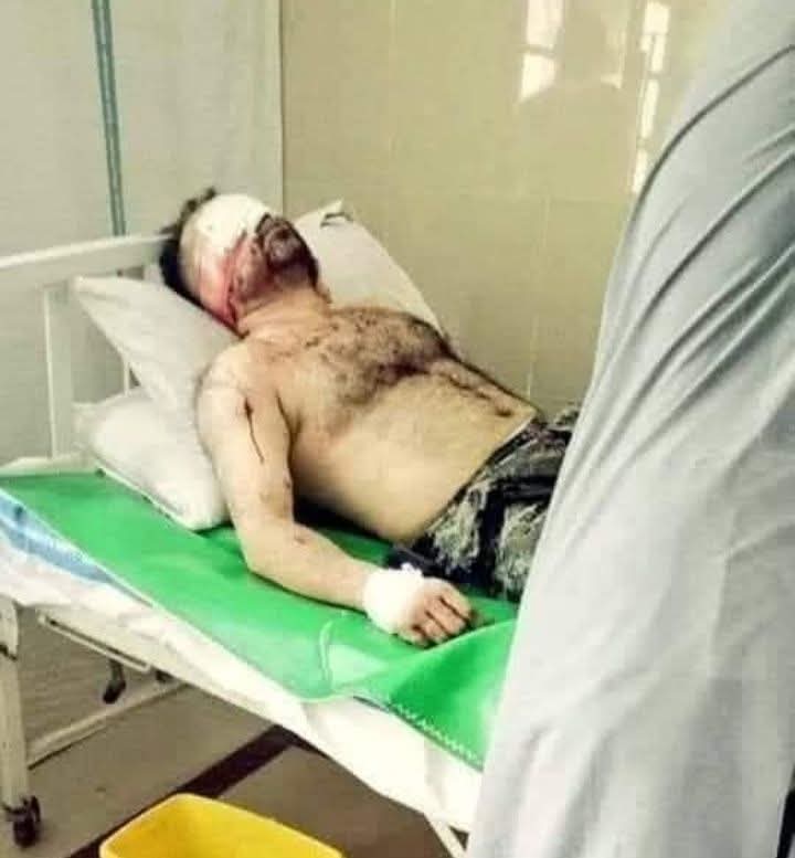 یہ بیڈ پر لیٹا کوئی عام فوجی نہیں بلکے برگیڈیئر ایوب حیدر ہیں جنہیں تمغہ امتیاز سےنوازا گیا جنہوں نےمنشیات سمگلروں کے خلاف آپریشن میں اپنی دونوں آنکھیں کھوں  دیں ہیں😥😥۔
پاکستان ہمشیہ زندہ باد پاک فوج پائندہ باد 💖💖💖💖💖 🇵🇰