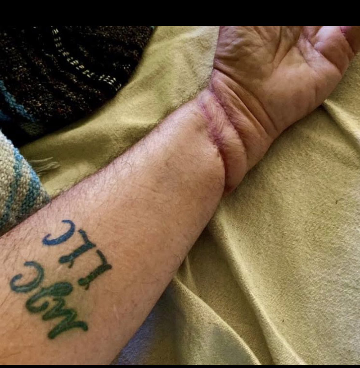 This poor guy attempted suicide after losing access to his pain medication

Of course, mainstream media would never cover this. 

If anything, they would accuse him of being a drug addict and that’s why he attempted suicide.
