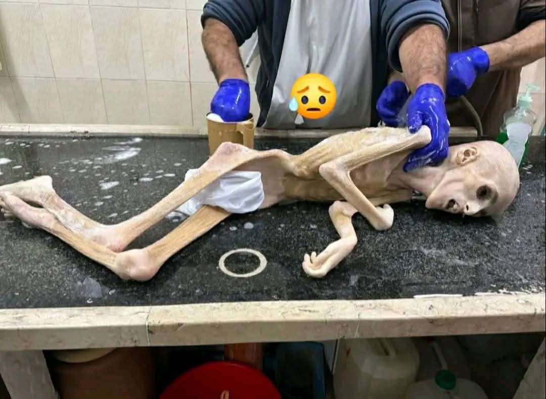تلكم هي غزة وأبنائها يا أمة الملياري مسلم ..  حسبنا الله ونعم الوكيل فيكم .. نسأله تعالى أن يقتص منكم ويريكم بأسه وقوته .. وأن يرينا فيكم عجائب قدرته في الدنيا قبل الأخره .