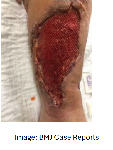 Mayo Clinic Infectious Diseases tweet media