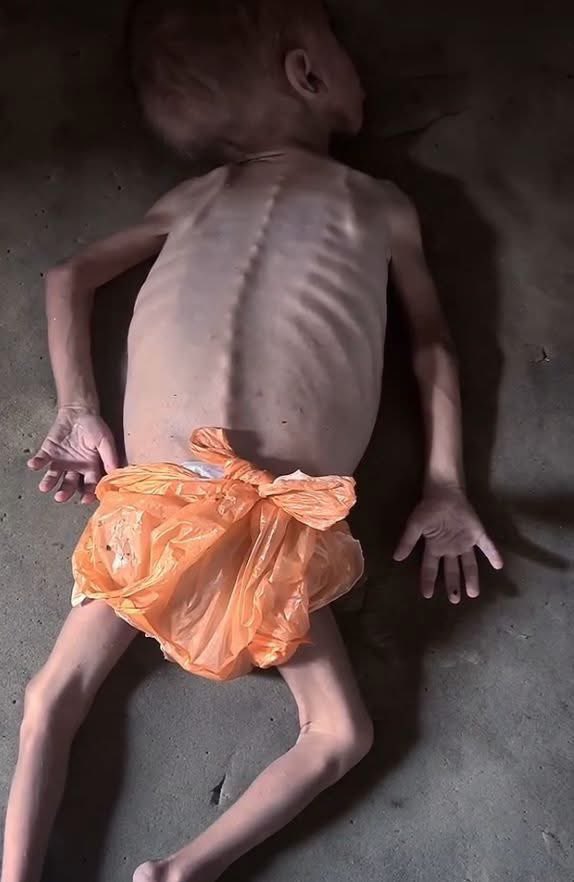 No food and no diapers 

Due to the lack of diapers, mothers use nylon sheets or bags for their babies!

This only happens under Israeli occupation