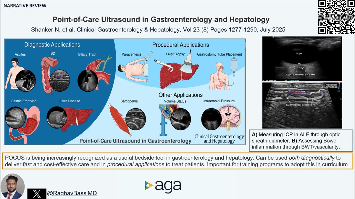 #CGH4ALL <a href="/AGA_CGH/">CGH</a> 📣

POCUS use in gastroenterology and hepatology is relatively new.

Can be used to diagnose:
✅ Ascites and Hepatic Hydrothorax
✅ Liver Steatosis and Fibrosis
✅ Gallbladder disease
✅ Gastric Emptying
✅ IBD 
✅ Bowel obstruction 
✅ Optic Nerve Sheath