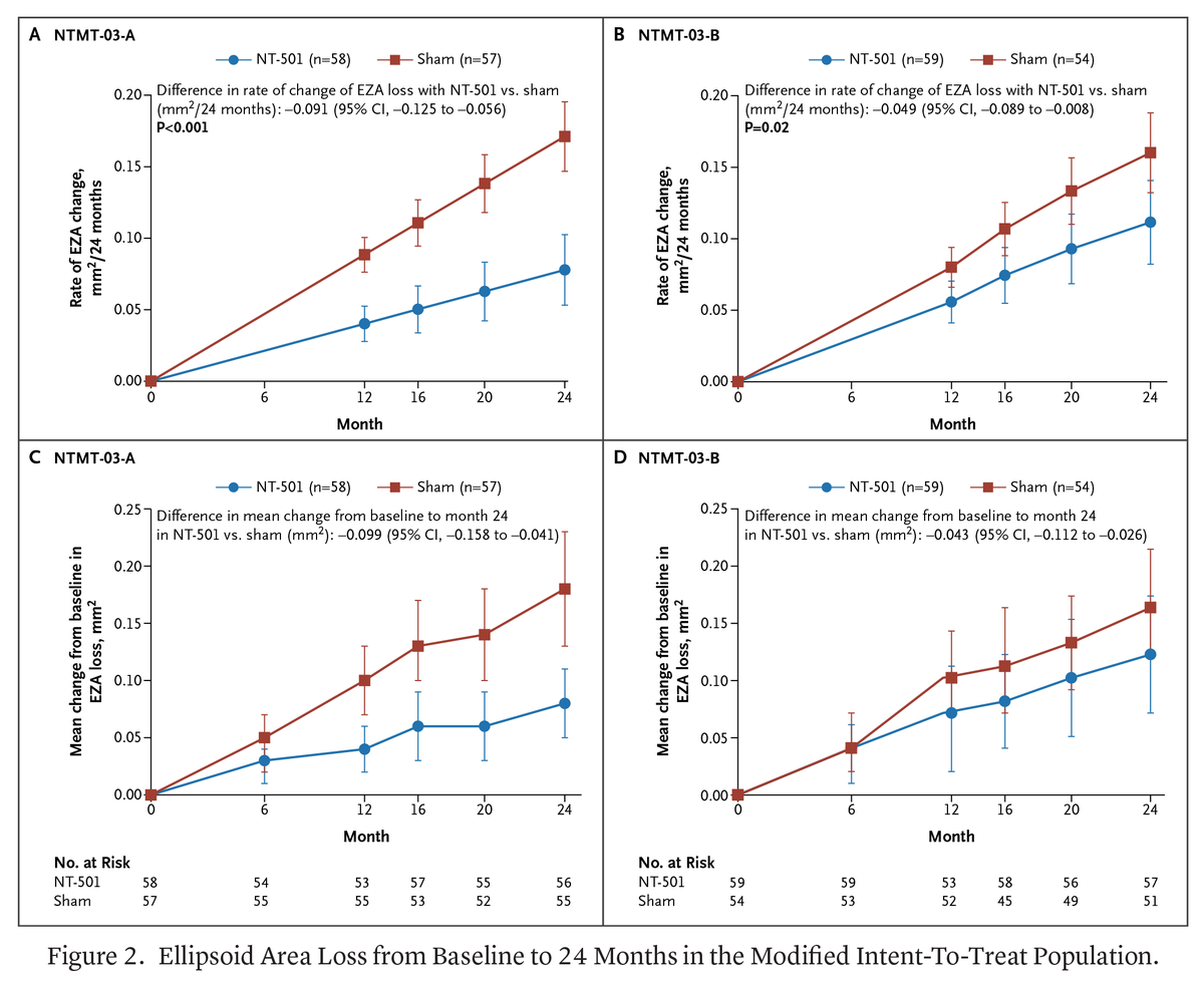 NEJM Evidence (@nejmevidence) on Twitter photo In two phase 3 trials, revakinagene taroretcel surgically implanted into eyes of patients with macular telangiectasia type 2 significantly reduced ellipsoid zone area loss (photoreceptor) over 2 years compared to sham procedures. eviden.cc/3UnknIZ In two phase 3 trials, revakinagene taroretcel surgically implanted into eyes of patients with macular telangiectasia type 2 significantly reduced ellipsoid zone area loss (photoreceptor) over 2 years compared to sham procedures. eviden.cc/3UnknIZ
