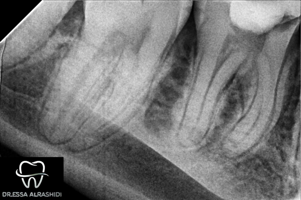 عيسى الرشيدي tweet media