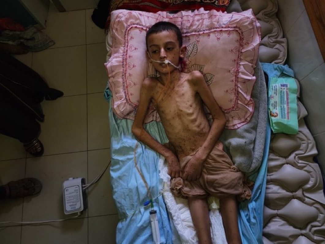 This is what Israel is doing to the CHILDREN of Gaza.   

He is just 10 years old…