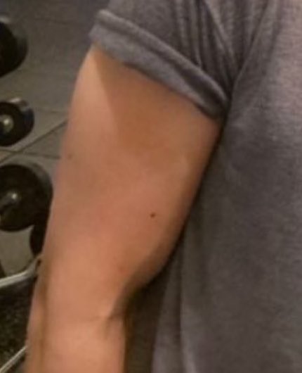 un ojo en el norte y otro en el sur un bizcocho menos para los ojos del elefante del brazo de taehyung