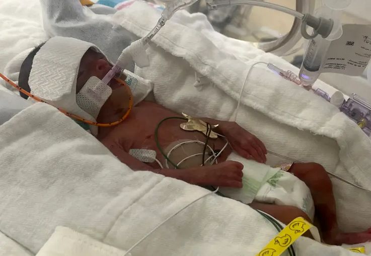 Baby Born at 24 Weeks, Size of a Barbie Doll, Heads Home From Hospital buff.ly/aVhRzfF