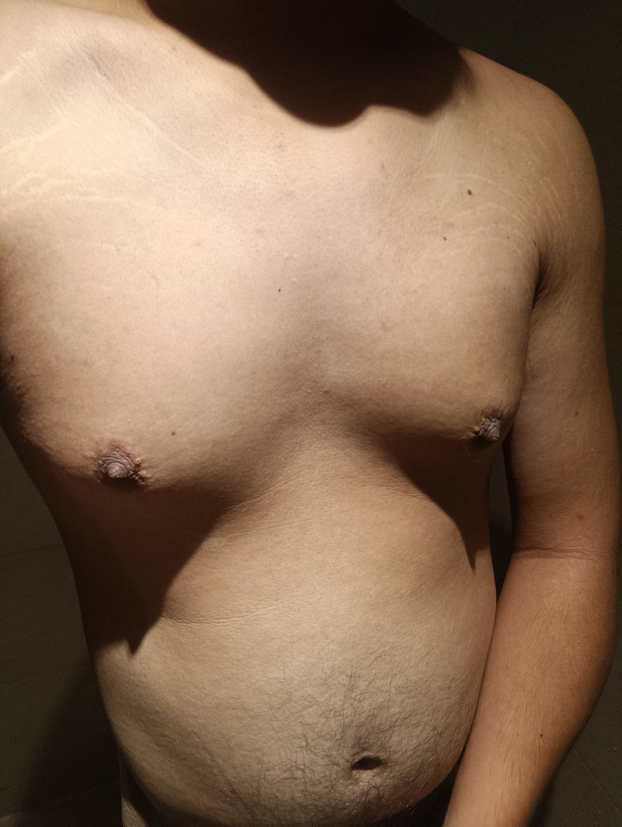 nipple feeder tweet media