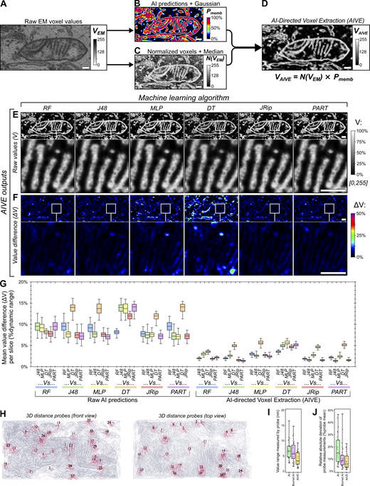 Rockefeller U. Press (@rockupress) on Twitter photo In <a href="/JCellBiol/">Journal of Cell Biology</a>, <a href="/BenjaminPadman/">Benjamin Padman</a> et al <a href="/LazarouLab/">Michael Lazarou</a> outline a segmentation strategy for 3D FIB-SEM data from cells, termed AIVE, & identify a new type of mitochondrial contact called the mitochondrial intrusion hubs.la/Q03zwF1q0 In <a href="/JCellBiol/">Journal of Cell Biology</a>, <a href="/BenjaminPadman/">Benjamin Padman</a> et al <a href="/LazarouLab/">Michael Lazarou</a> outline a segmentation strategy for 3D FIB-SEM data from cells, termed AIVE, & identify a new type of mitochondrial contact called the mitochondrial intrusion hubs.la/Q03zwF1q0