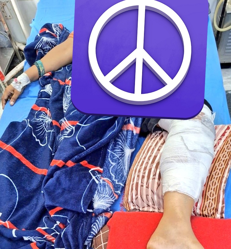 Saumya Gupta (@gsam2411) on Twitter photo गुरुग्राम की जर्जर सड़कें।
गड्ढे में स्कूटी फिसलने से महिला गंभीर रूप से घायल, पिछले 3 दिन से ICU में भर्ती। एक पैर में फ्रैक्चर।
जिम्मेदारों की खामोशी दर्द से कराहते शहर पर भारी पड़ रही है।
#Gurgaon #InfrastructureFail #gurugram
<a href="/cmohry/">CMO Haryana</a>
<a href="/DC_Gurugram/">DC Gurugram</a> <a href="/MunCorpGurugram/">MCG</a> गुरुग्राम की जर्जर सड़कें।
गड्ढे में स्कूटी फिसलने से महिला गंभीर रूप से घायल, पिछले 3 दिन से ICU में भर्ती। एक पैर में फ्रैक्चर।
जिम्मेदारों की खामोशी दर्द से कराहते शहर पर भारी पड़ रही है।
#Gurgaon #InfrastructureFail #gurugram
<a href="/cmohry/">CMO Haryana</a>
<a href="/DC_Gurugram/">DC Gurugram</a> <a href="/MunCorpGurugram/">MCG</a>
