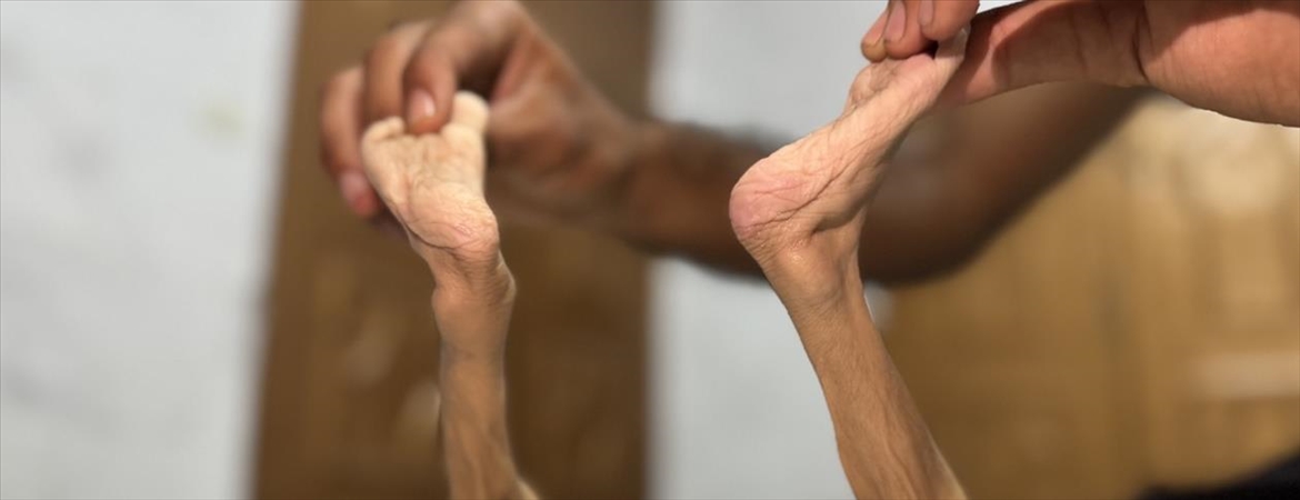 Gazze’de insani kriz derinleşiyor: Kıtlık, etnik temizlik stratejisinin parçası haline geldi. Yaşananlar uluslararası düzenin vicdanını sorgulatıyor. 👇

🔎 Ayrıntılar  ve 🎧 #Podcast için:
🟥 Gazze’de “Kıtlığın En Kötü Senaryosu” ve “İnsanlığın Vicdanı” | Kadir Üstün
🔗