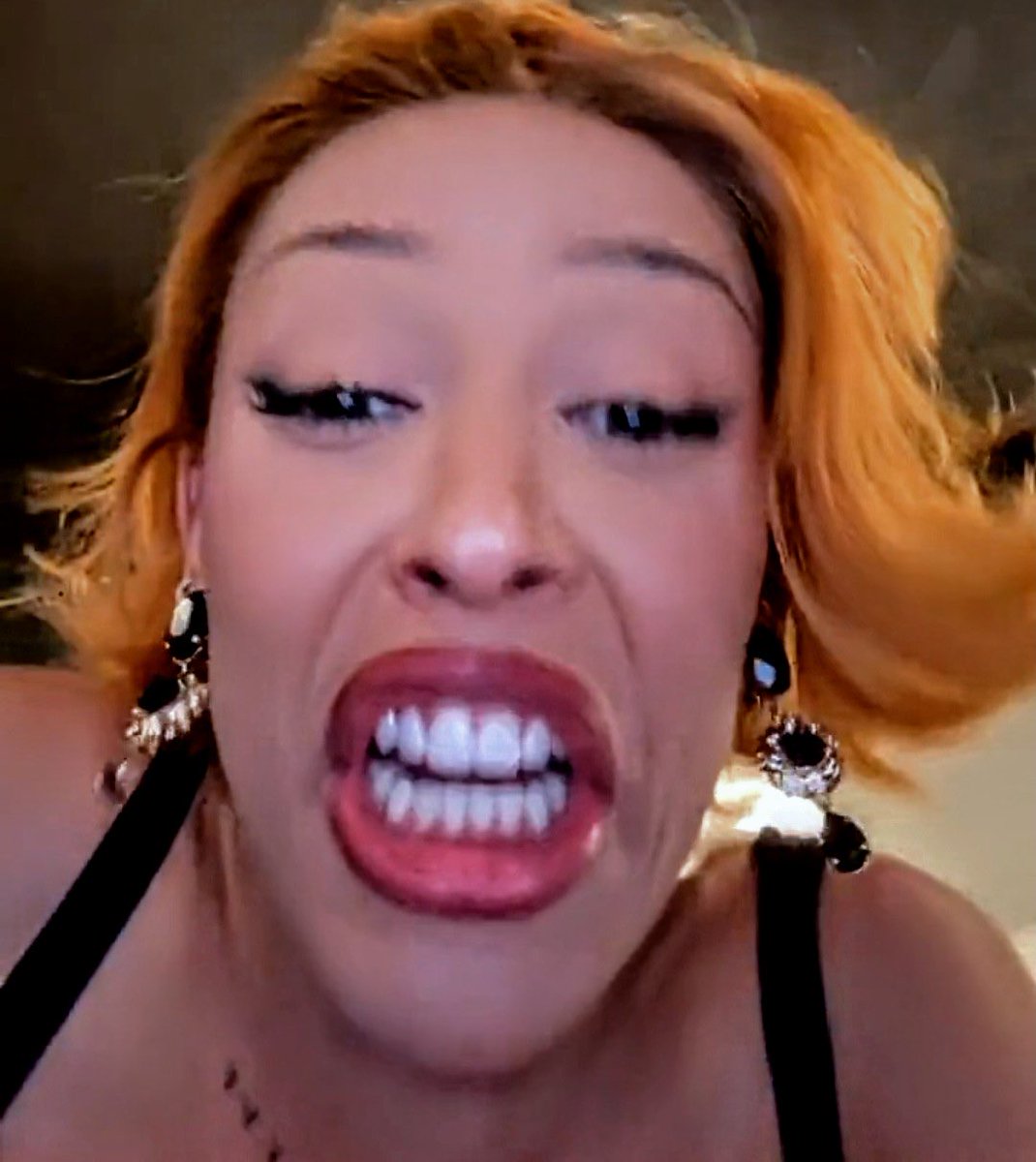 Whys <a href="/DojaCat/">DOJA CAT</a> appropriating Caucasians while criticizing one?
She is not a natural blonde!

What up with her mouth…does she have extra teeth? It’s really wide!
Her makeup looks like if it gets hot, it’ll melt.

We all know they hate <a href="/sydney_sweeney/">Sydney Sweeney</a>  because beautiful.