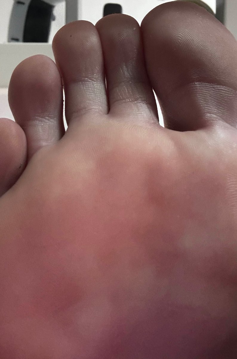 DefeetofFace's tweet image. Have at it. #feet #sole #giantess #footfetish 

DM for custom rates if interested.