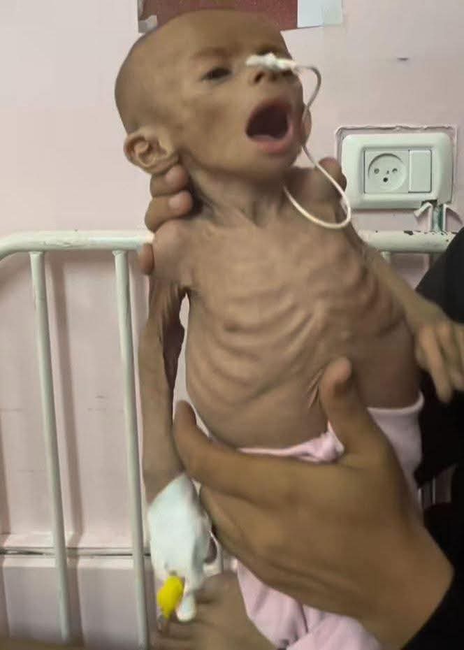 كانت هذه آخر نظرة تستغيث بها طعامًا أو حليبًا قبل أن تلفظ أنفاسها الأخيرة!
وفاة الطفلة الرضيعة زينب أبو حليب (6 أشهر) في مستشفى ناصر الطبي في خانيونس بسبب الجوع الشديد.