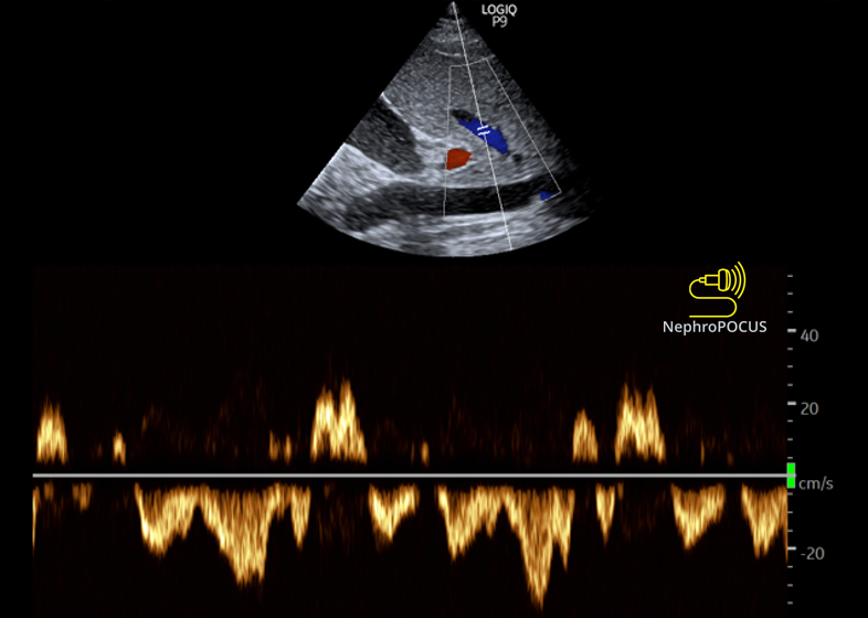 NephroPOCUS tweet media