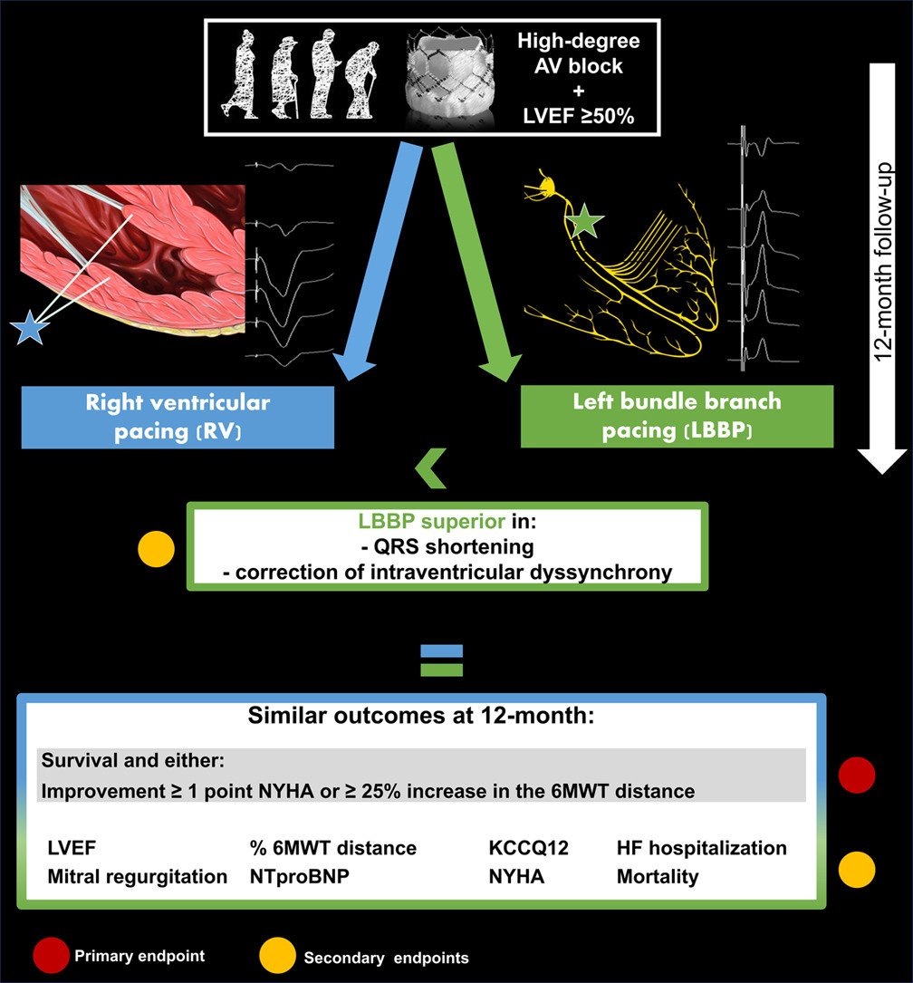 Margarida Pujol Lopez (@margaridapujol) on Twitter photo Online OpenAcc. our small Pilot trial: PhysTAVI
<a href="/CJCJournals/">CJC Journals</a> CanadianJournal of CardiologyOpen
LBBPvsRVpacing (AVBpostTAVI, ✅LVEF)
ClinicalTr NCT04482816
Colab our Interv Card Group <a href="/hospitalclinic/">Hospital Clínic</a> <a href="/AnderRegueiro/">Ander Regueiro</a>
<a href="/JlmontGirbau/">Lluis Mont i Girbau</a> <a href="/tolosanaviu/">Jose Maria tolosana</a> <a href="/EduGuasch/">Eduard Guasch</a>
cjcopen.ca/article/S2589-… Online OpenAcc. our small Pilot trial: PhysTAVI
<a href="/CJCJournals/">CJC Journals</a> CanadianJournal of CardiologyOpen
LBBPvsRVpacing (AVBpostTAVI, ✅LVEF)
ClinicalTr NCT04482816
Colab our Interv Card Group <a href="/hospitalclinic/">Hospital Clínic</a> <a href="/AnderRegueiro/">Ander Regueiro</a>
<a href="/JlmontGirbau/">Lluis Mont i Girbau</a> <a href="/tolosanaviu/">Jose Maria tolosana</a> <a href="/EduGuasch/">Eduard Guasch</a>
cjcopen.ca/article/S2589-…
