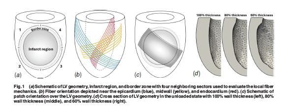 ASMEJournals's tweet image. The role of infarct stiffness in #cardiac patch therapy: A computational study using an idealized left ventricular geometry. asmedigitalcollection.asme.org/biomechanical/…
#biomedical #fibers