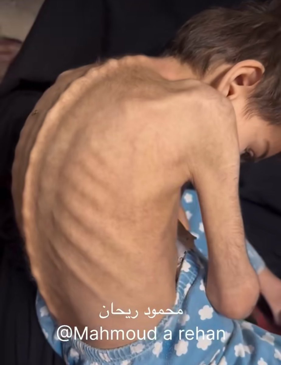 Look at this 🇵🇸💔