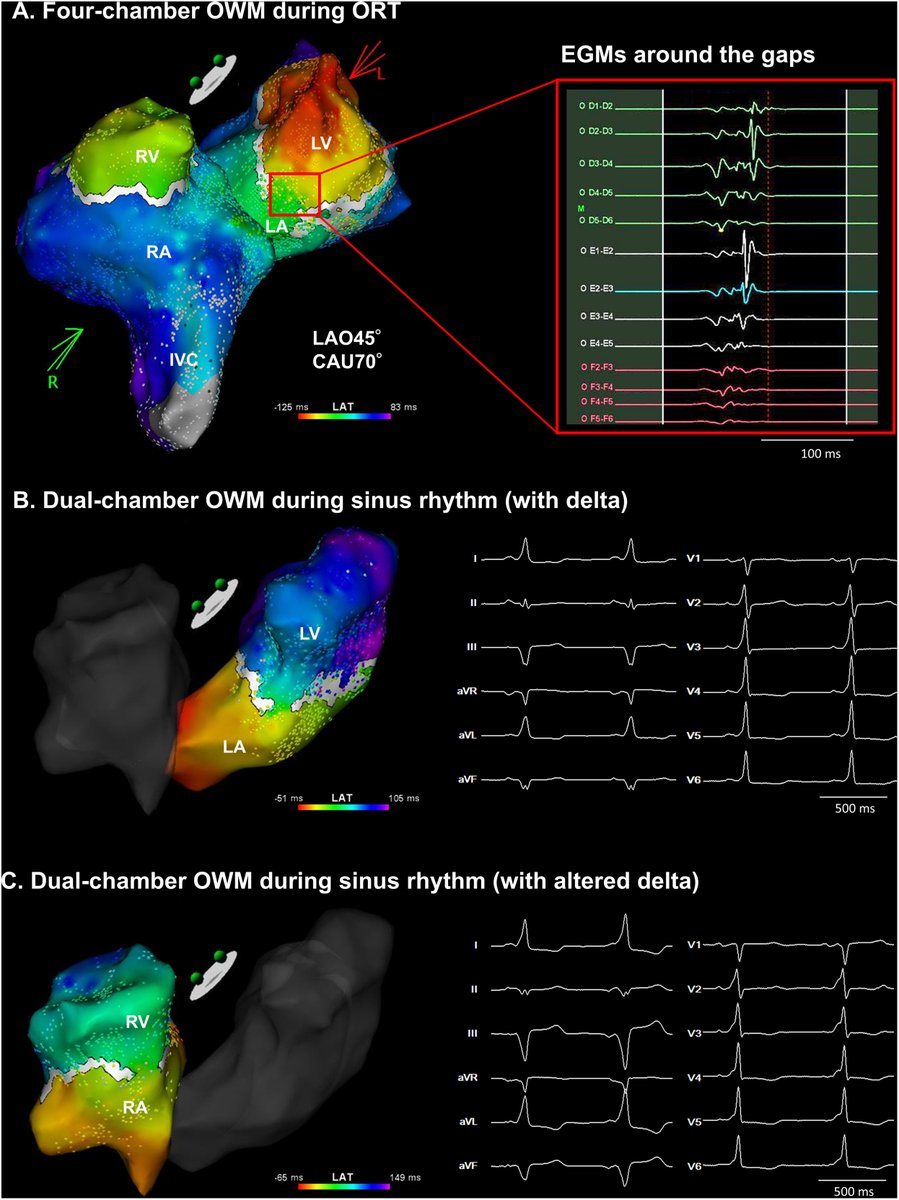 Heart Rhythm Case Reports tweet media