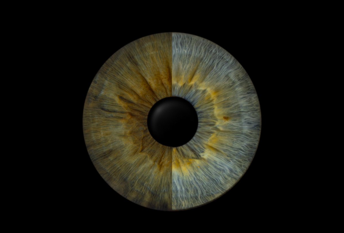 Мы с подругой наконец-то сделали красивые фотки глаз
Я так и не поняла, какого цвета мой глаз, он ещё и не ореховый как я думала, в нем есть даже голубой
Смешное