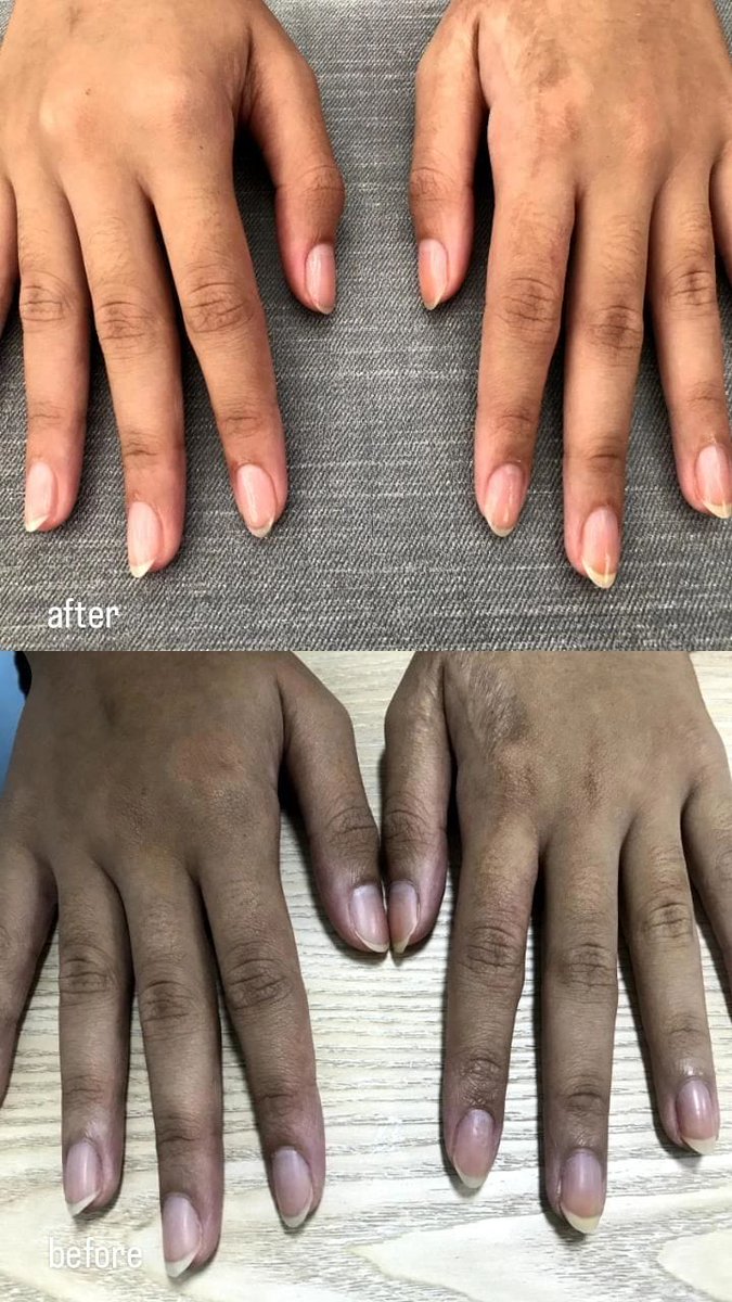 #الغاء_عقوبه_دخيل_اللّه 
#الجبل_الاخضر 
#كاريزما20
#سامي
لطلب الخلطه رابط واتساب بالبايو