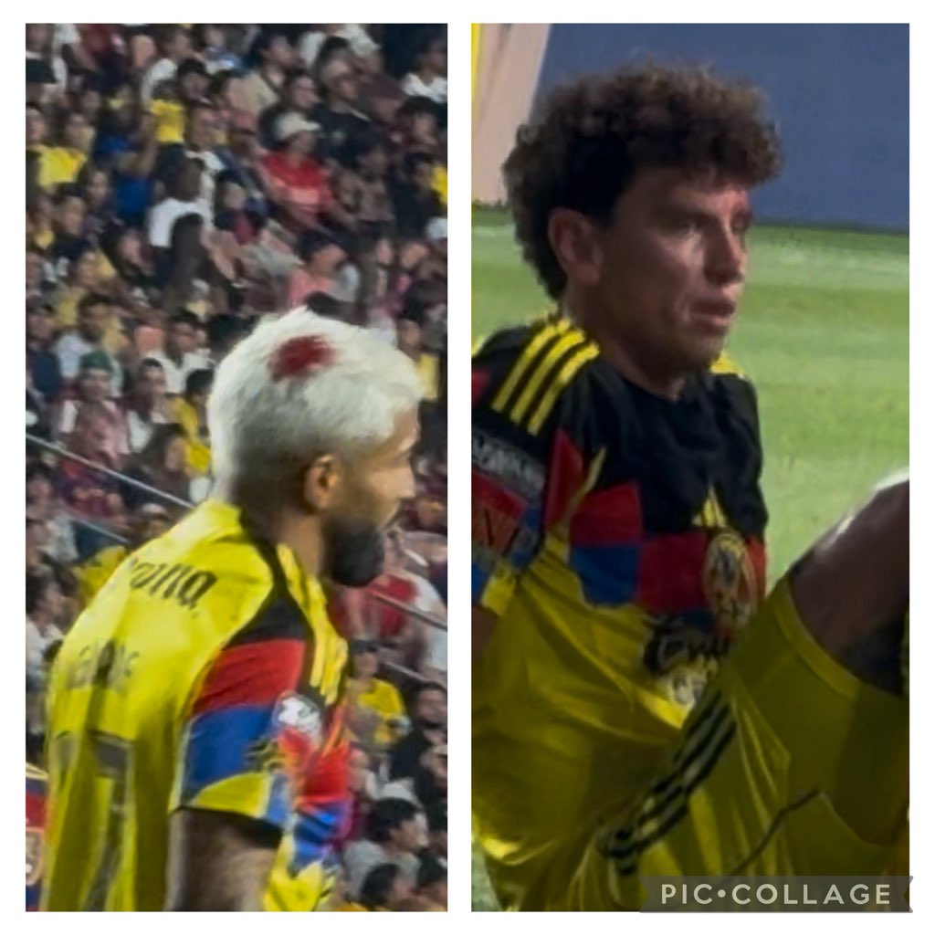 Durísimo impacto entre el Búfalo e Igor <a href="/TUDNMEX/">TUDN MEX</a> <a href="/TUDNUSA/">TUDN USA</a>