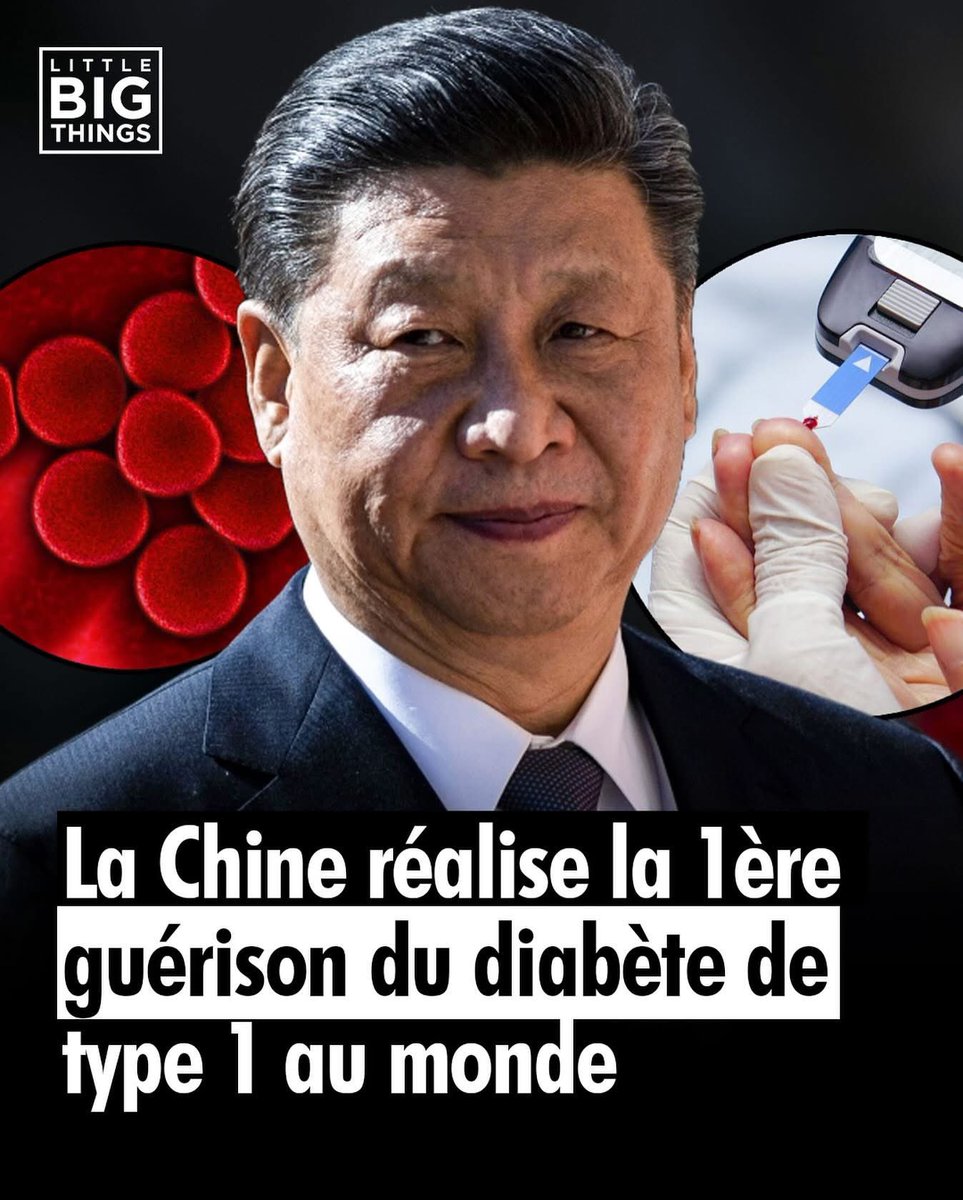 La Chine réalise la première guérison du diabète de type 1 au monde.

« Une jeune femme chinoise de 25 ans atteinte de diabète de type 1 a recommencé à produire de l’insuline après une greffe de cellules souches issues de son propre corps. Injectées dans ses muscles abdominaux,