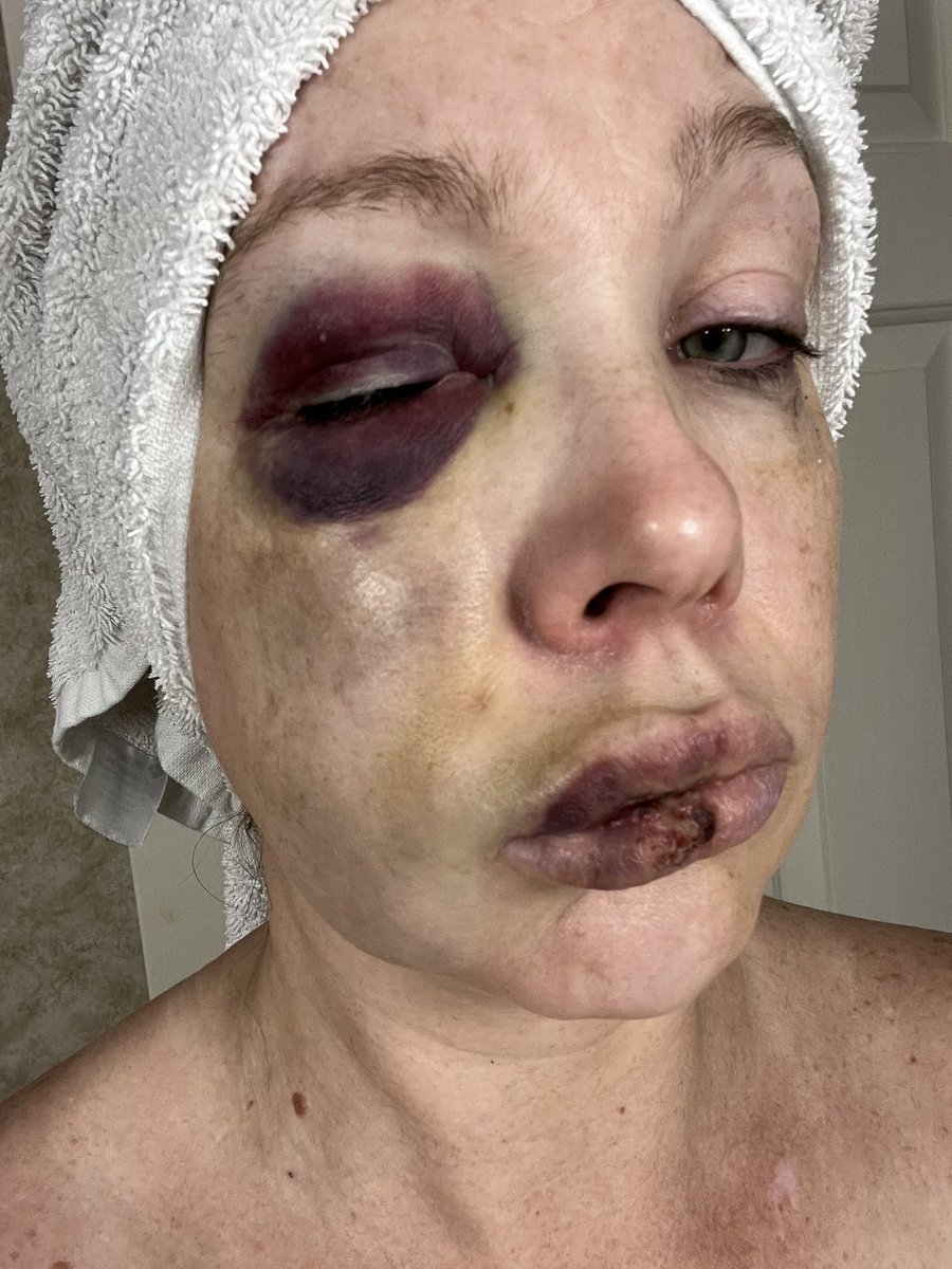 So just to summarize:

-A city councilor said she begged for this

-Police chief said social media is misrepresenting it

-A woke judge let the attacker out on $400